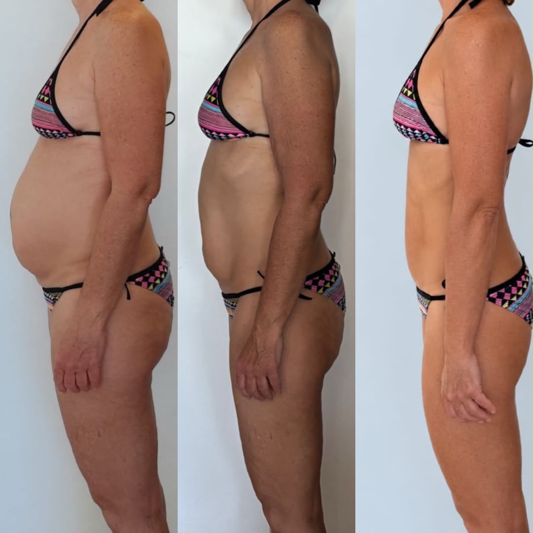Olga, experiencia con el método para desinflamar