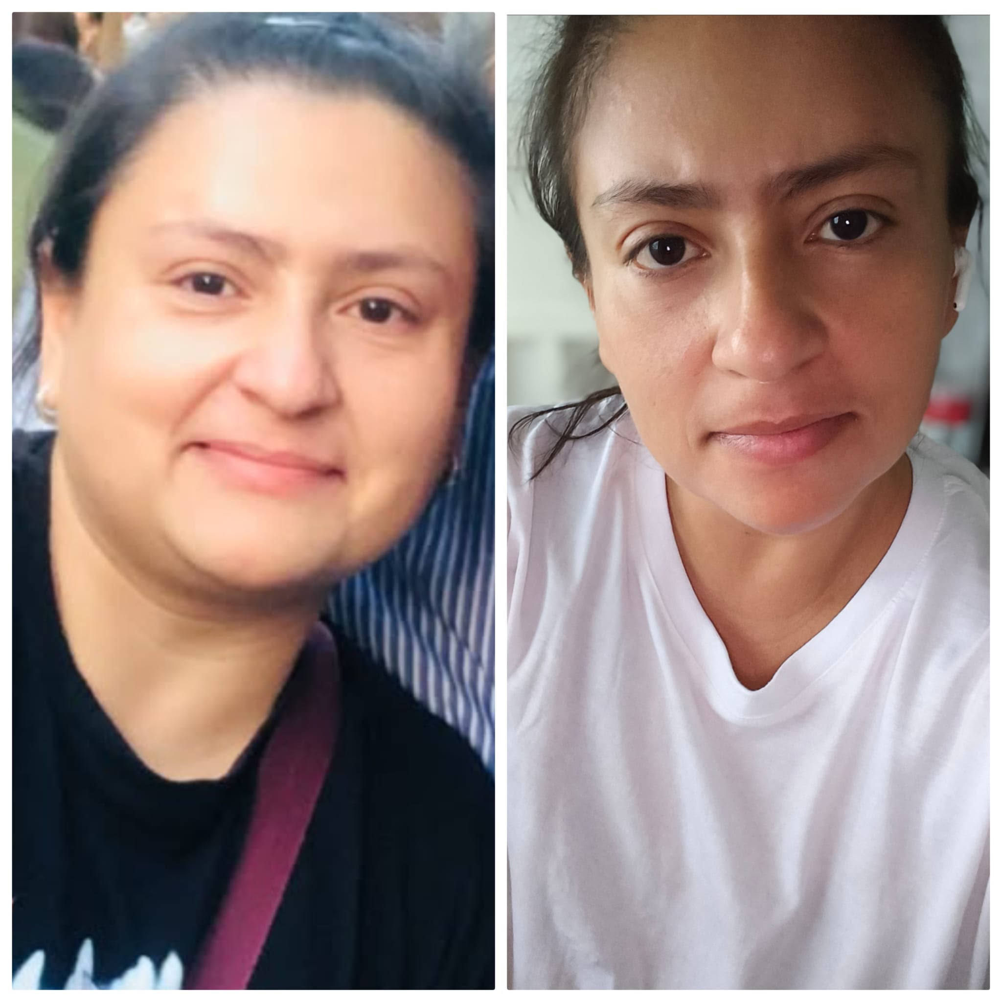 Perla, 42 años, experiencia con el método para desinflamar